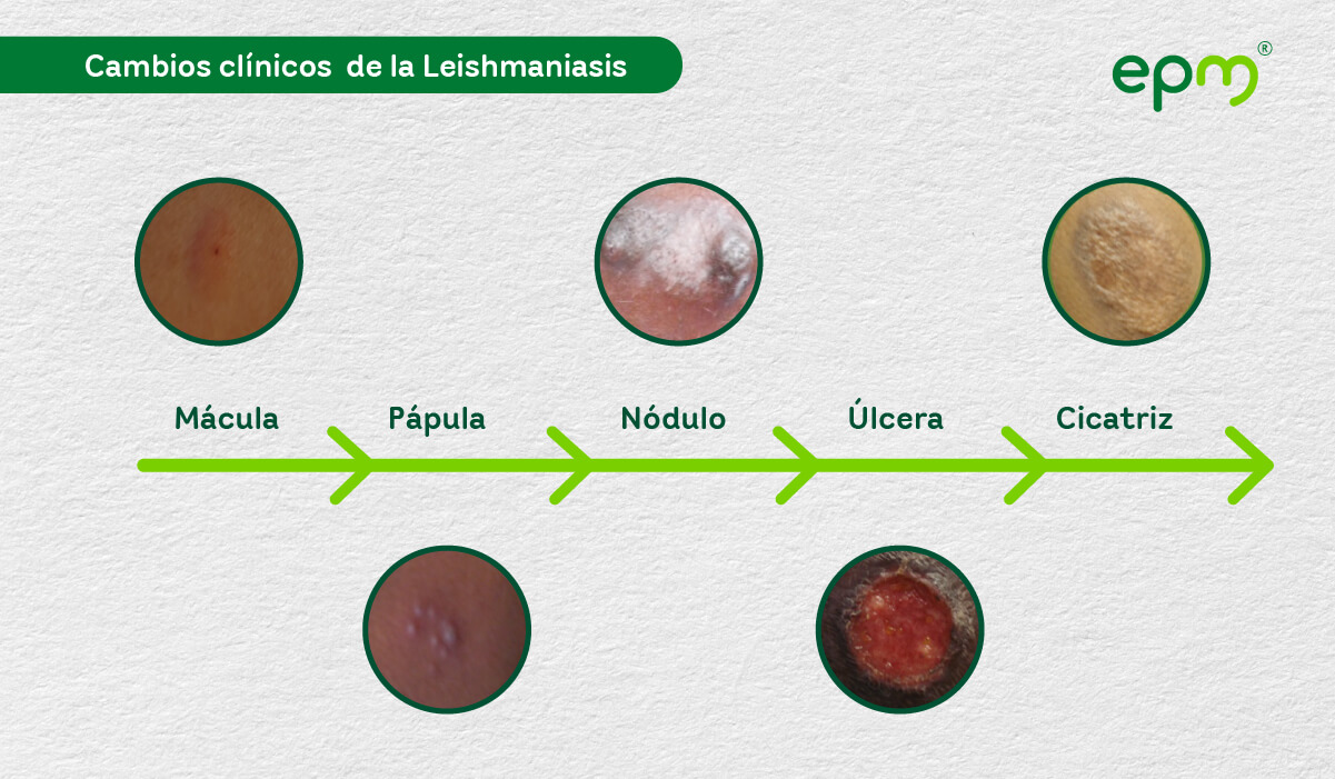 diagrama-2 -cambios-clinicos-de -a-Leishmaniasis